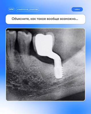 Сколько проблем на снимке? Смех сквозь слёзы.